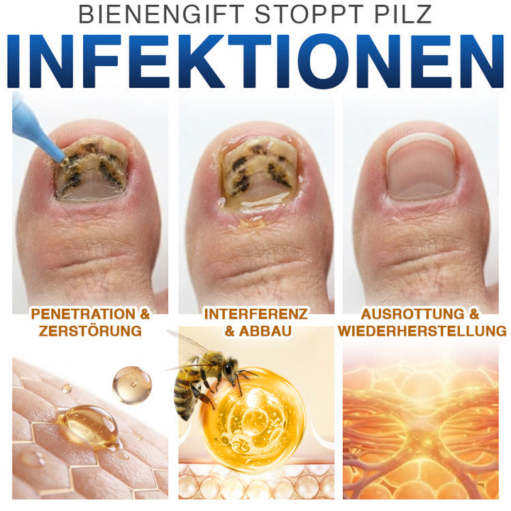 NailLuxe™ – Premium Nagelpflege mit Bienengift für schöne Nägel