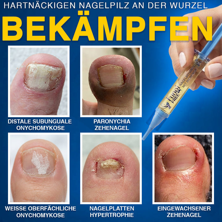 NailLuxe™ – Premium Nagelpflege mit Bienengift für schöne Nägel