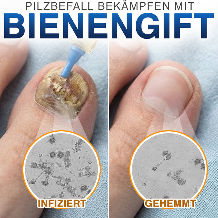 NailLuxe™ – Premium Nagelpflege mit Bienengift für schöne Nägel