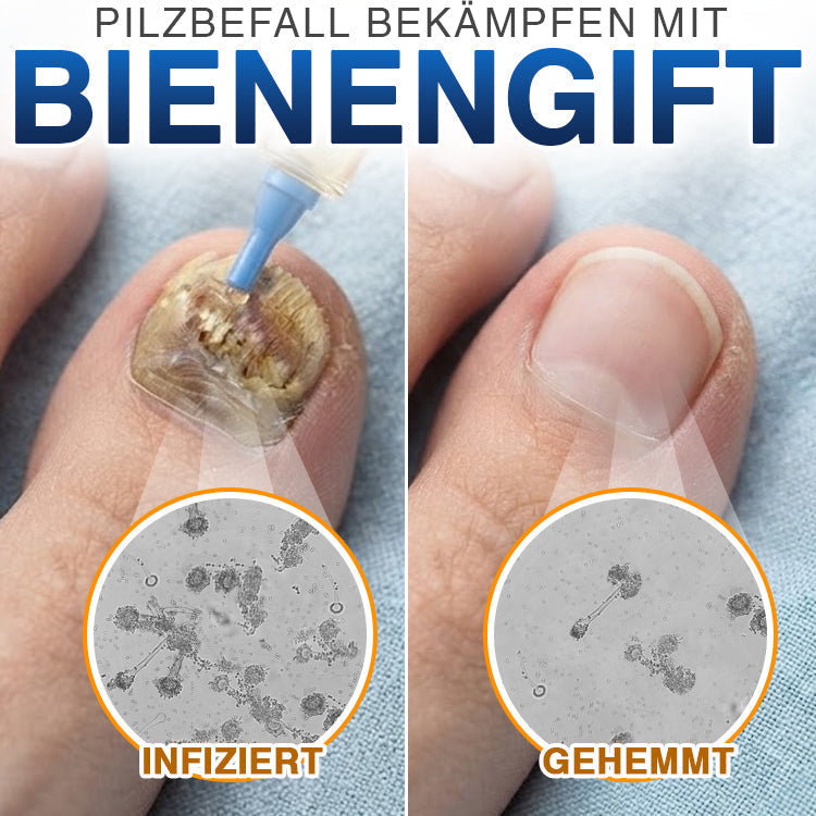 NagelKraft™ Bienengift-Nagelpflege