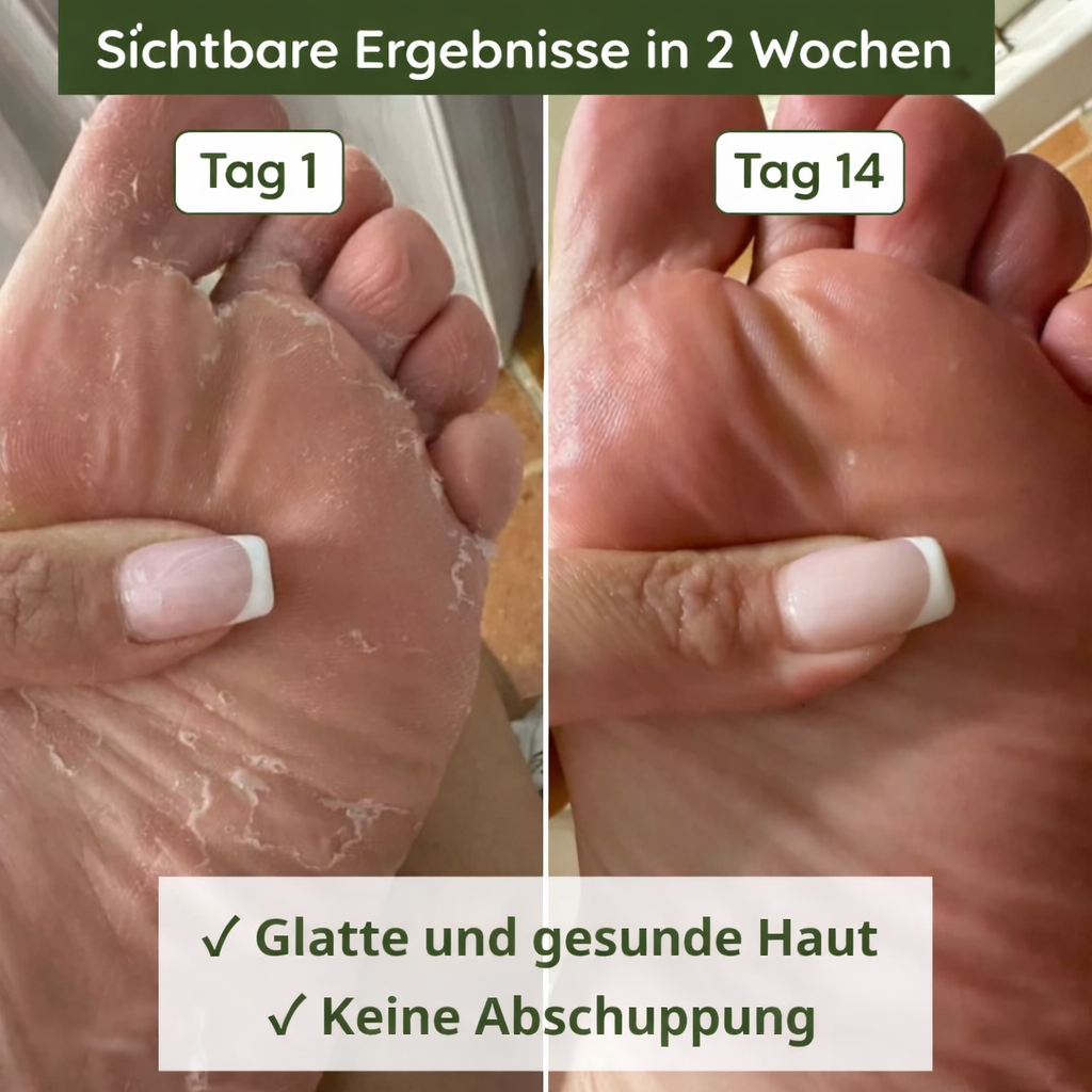 PilzKlar™ Anti-Pilz-Seife
