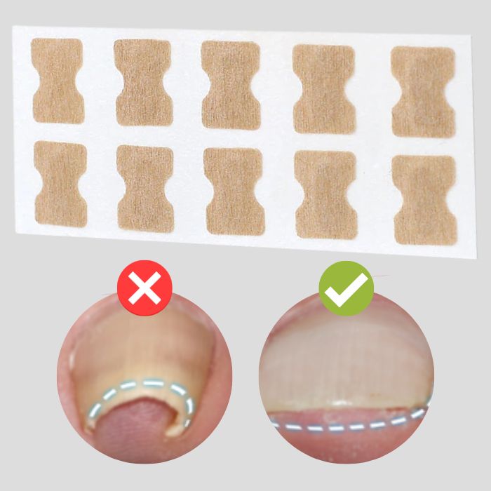 FinePatches™ – Korrekturpflaster für schöne, starke und gesunde Nägel [50 % Rabatt]