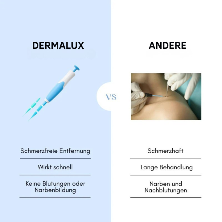 Dermalux® | Nie wieder Hautanhängsel