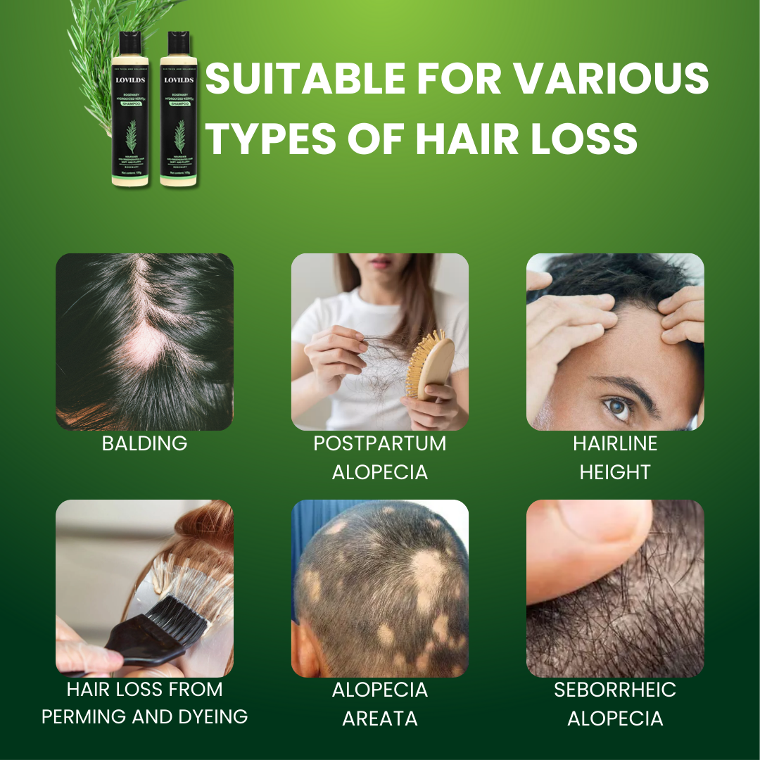 LOVILDS™ – Für dichteres, volleres Haar für gesundes, kräftiges & glänzendes Haarwachstum [50% Rabatt]