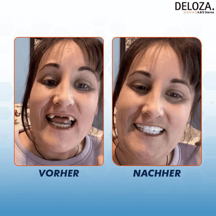 DentureBite™ – Für ein natürlich wirkendes, selbstbewusstes Lächeln [50 % Rabatt]