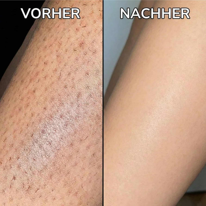 HaarStopp™ Pflanzliche Haarwuchs-Pflege