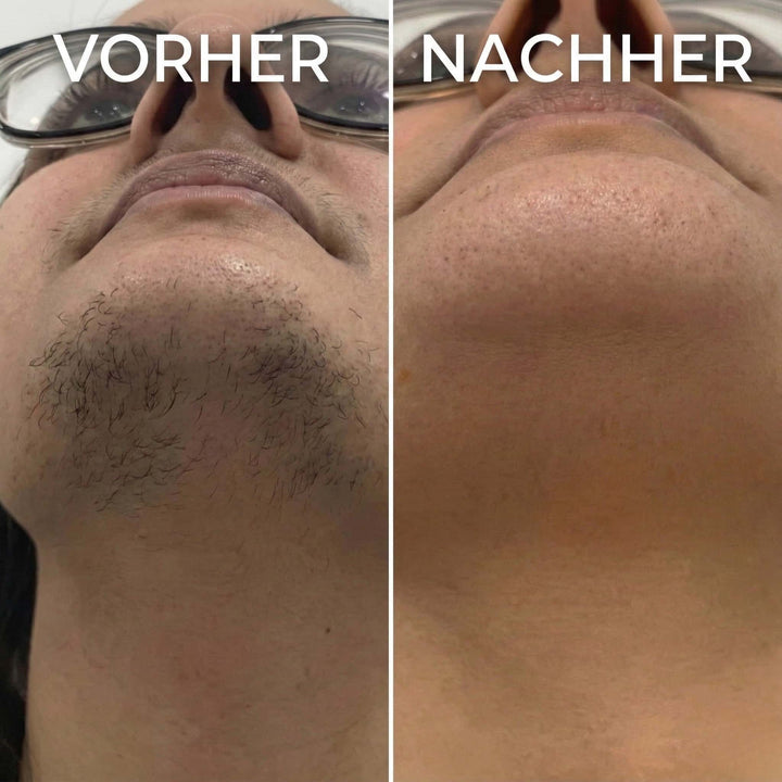 HaarStopp™ Pflanzliche Haarwuchs-Pflege