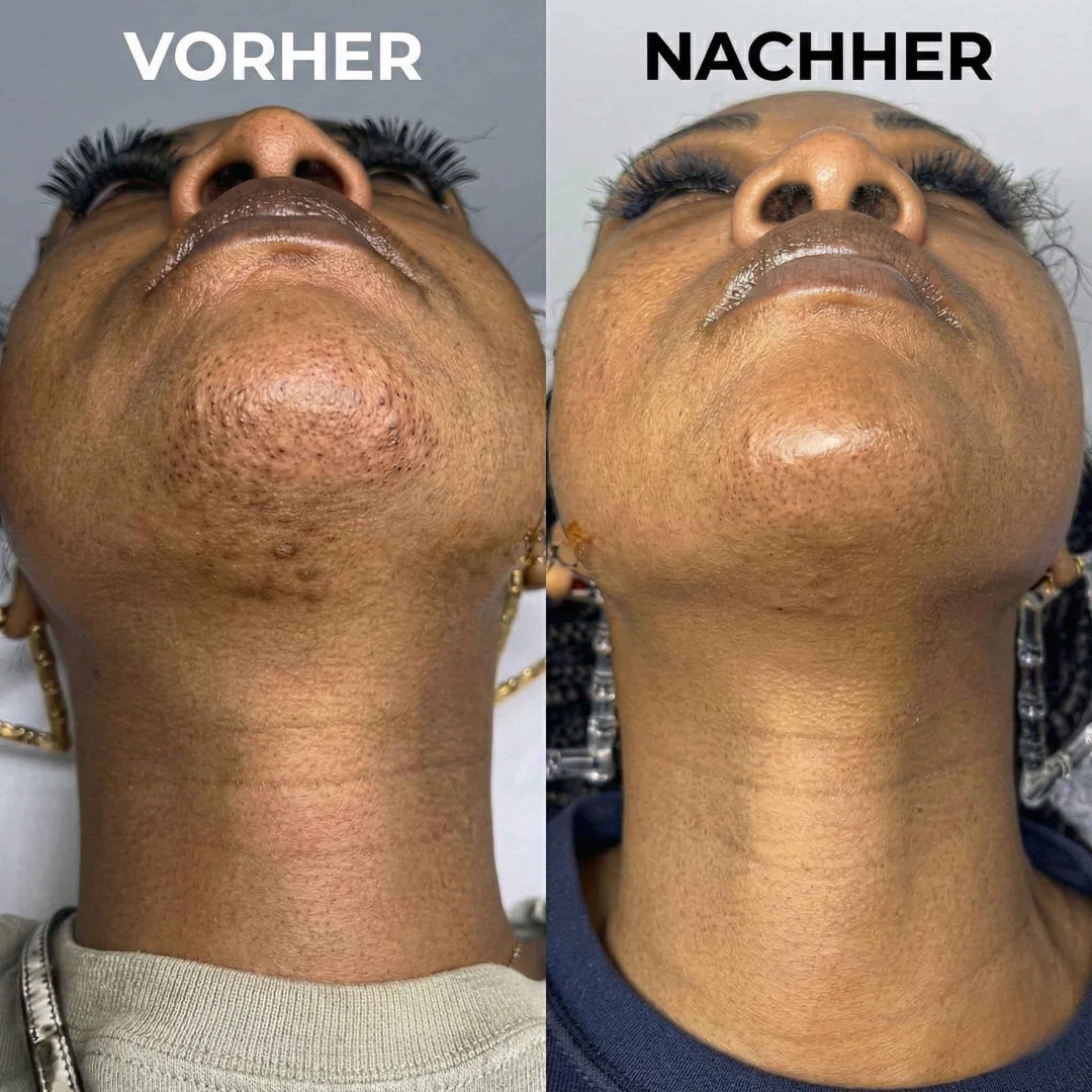 HaarStopp™ Pflanzliche Haarwuchs-Pflege