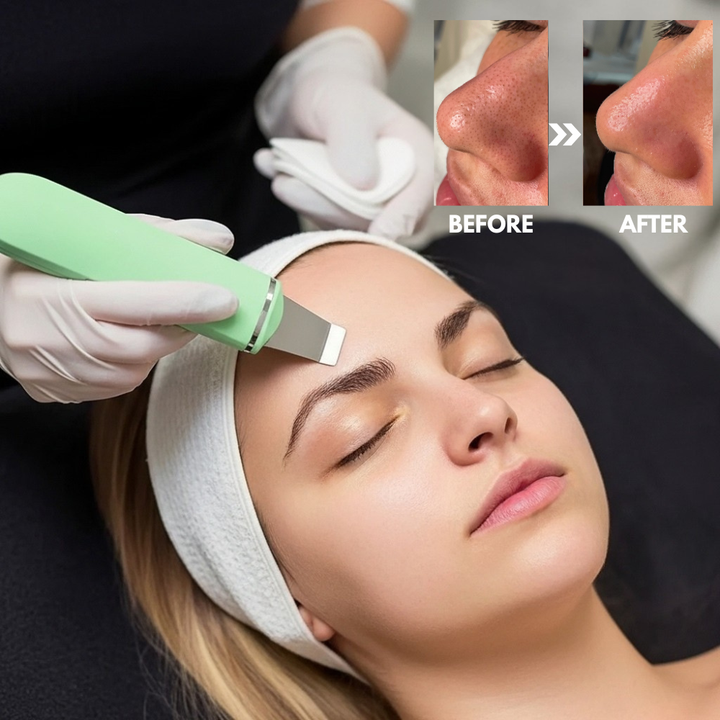 SkinSonic™ – Ultraschall-Skin-Scrubber, Tiefenreinigung & strahlende, gesunde Haut [50% Rabatt]