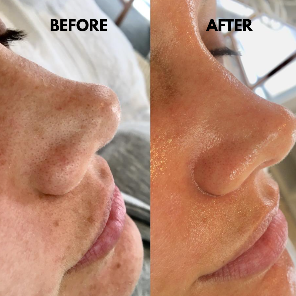 SkinSonic™ – Ultraschall-Skin-Scrubber, Tiefenreinigung & strahlende, gesunde Haut [50% Rabatt]