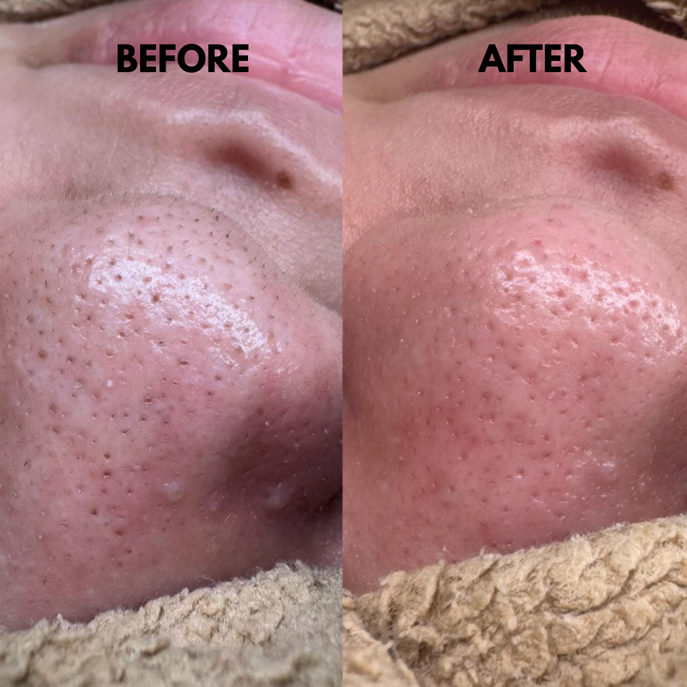 SkinSonic™ – Ultraschall-Skin-Scrubber, Tiefenreinigung & strahlende, gesunde Haut [50% Rabatt]