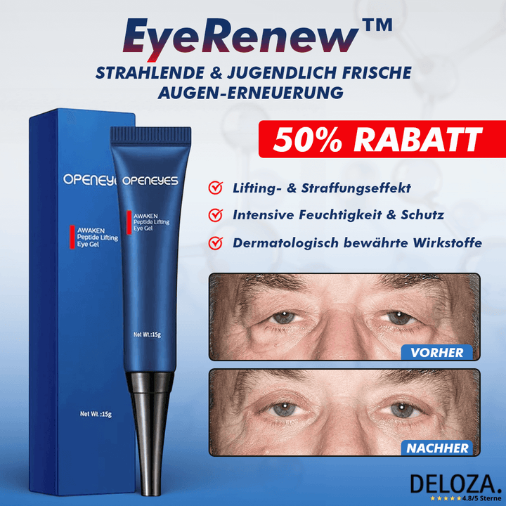 EyeRenew™ – Strahlende & jugendlich frische Augen-Erneuerung [50 % Rabatt]