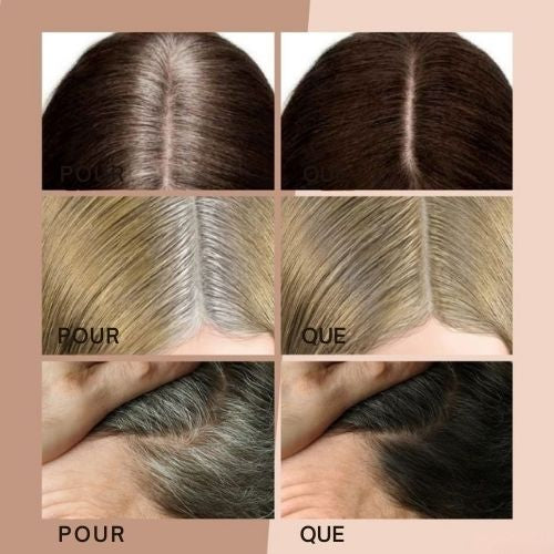 HairHalo™ – Sag Lebewohl zu Haaransätzen in einem Augenblick für perfektes Haar [1 + 1 Gratis]