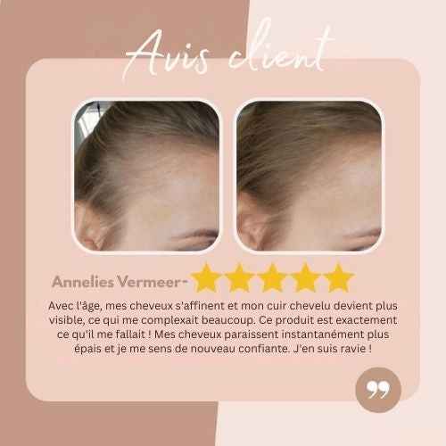 HairHalo™ – Sag Lebewohl zu Haaransätzen in einem Augenblick für perfektes Haar [1 + 1 Gratis]