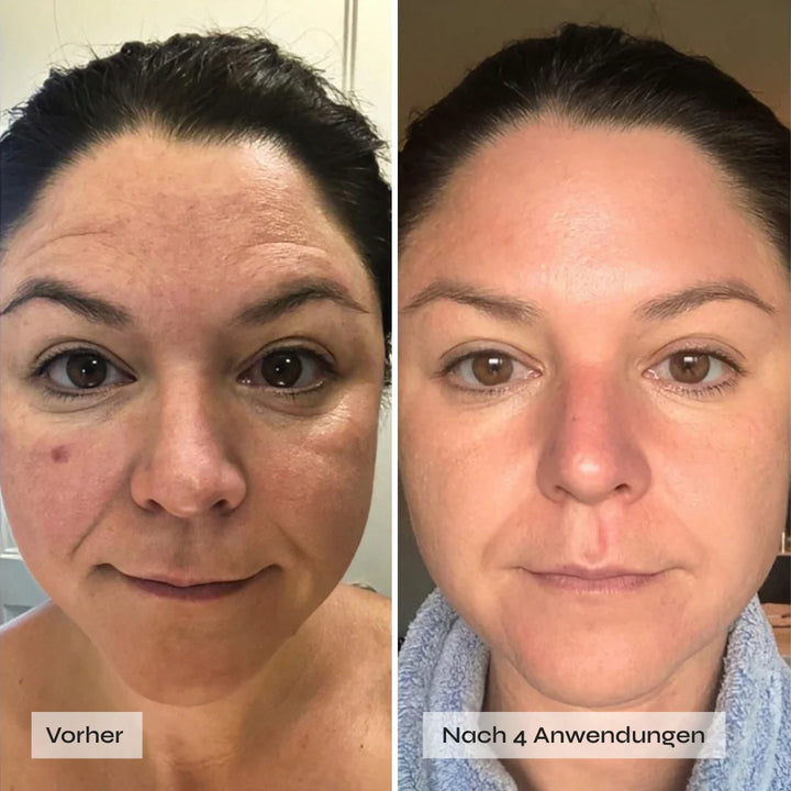 Kollagen Boosting Maske