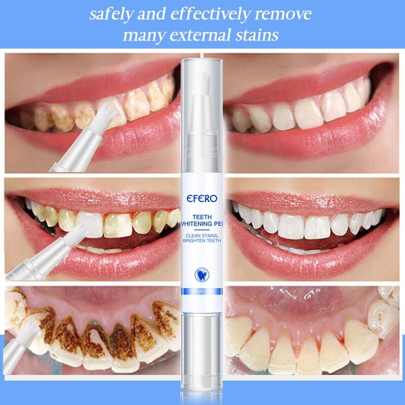WhiteEssence™ – Zahnaufhellungsstift für Strahlend Weiße & Gesunde Zähne [1 + 1 Gratis]