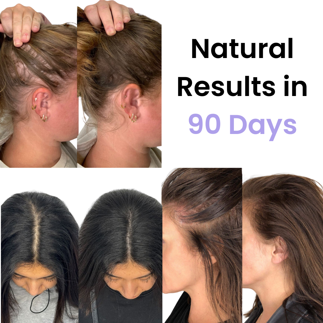 TheraBrush | Die natürliche 4in1-Lösung für Haarwachstum und Haarausfall