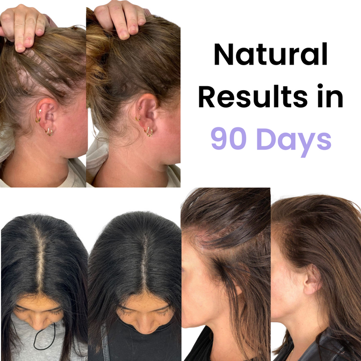 TheraBrush | Die natürliche 4in1-Lösung für Haarwachstum und Haarausfall