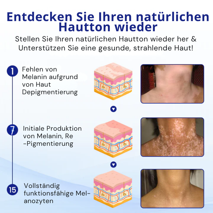 HautHarmonie™ Pflanzliches Hautpflegespray