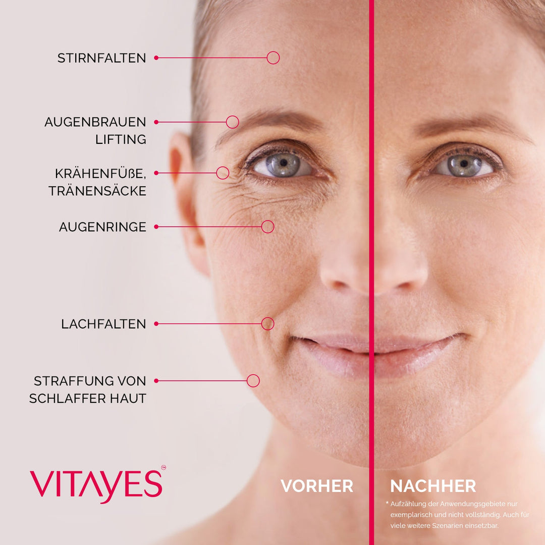 RejuvaEye™ Lifting-Creme für glattere und strahlendere Augenpartie