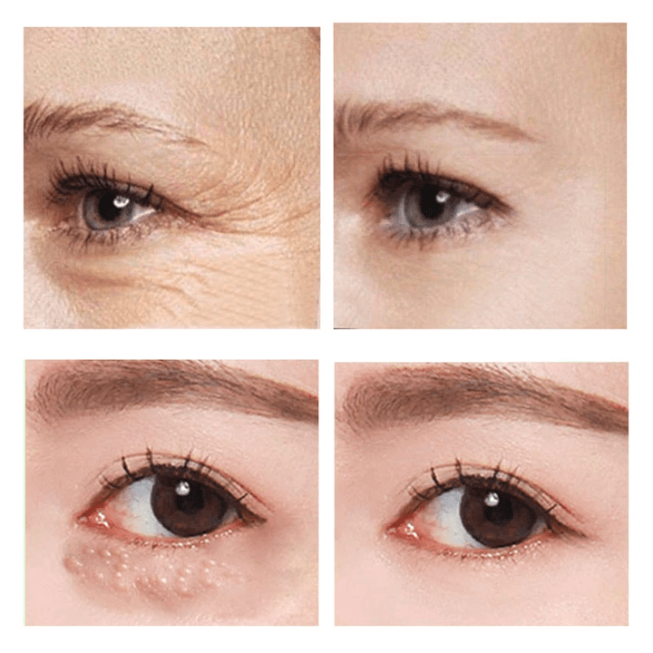 SleekEyes™ – Schnell wirkende straffende Augencreme für glatte, gepflegte Augenpartie [1 + 1 Gratis]