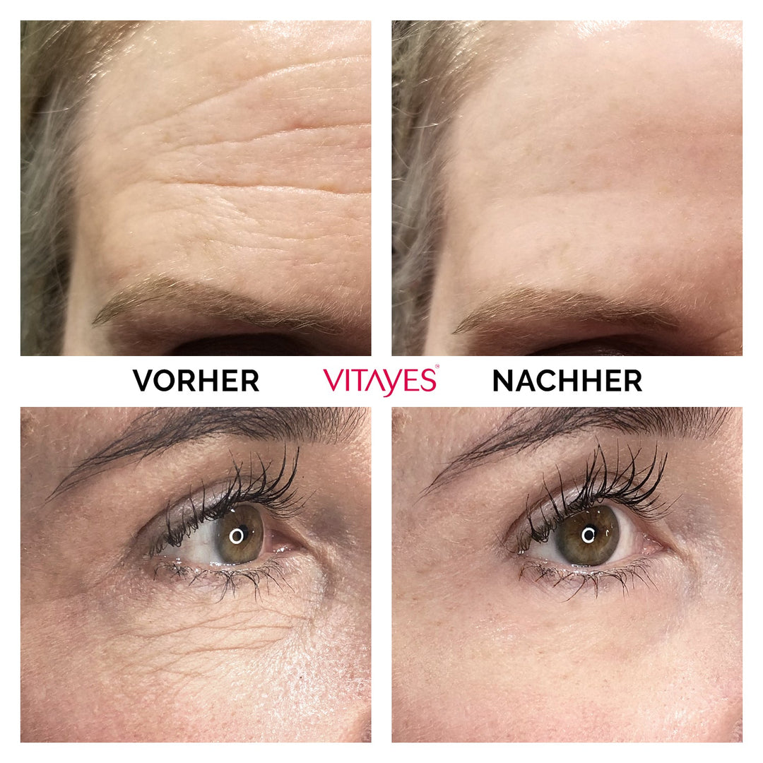 RejuvaEye™ Lifting-Creme für glattere und strahlendere Augenpartie