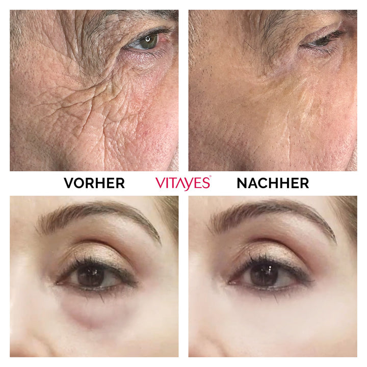 RejuvaEye™ Lifting-Creme für glattere und strahlendere Augenpartie