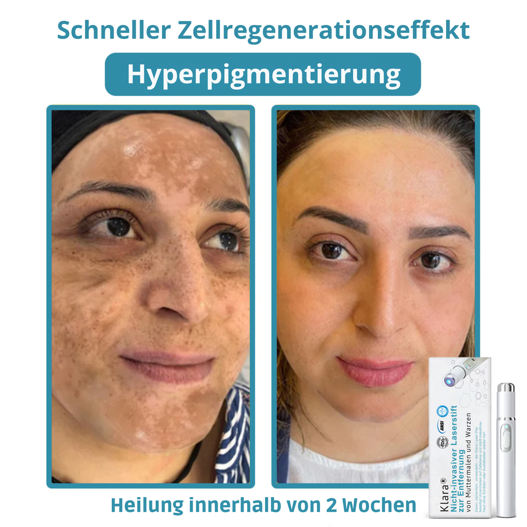Klara™ – Enthülle jederzeit makellose, strahlende Haut und Selbstvertrauen [50% Rabatt]