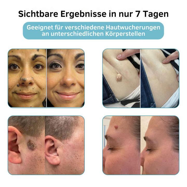 Klara™ – Enthülle jederzeit makellose, strahlende Haut und Selbstvertrauen [50% Rabatt]