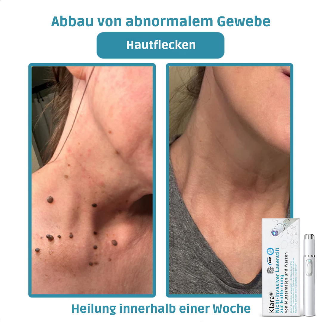 Klara™ – Enthülle jederzeit makellose, strahlende Haut und Selbstvertrauen [50% Rabatt]