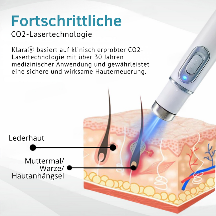 Klara™ – Enthülle jederzeit makellose, strahlende Haut und Selbstvertrauen [50% Rabatt]