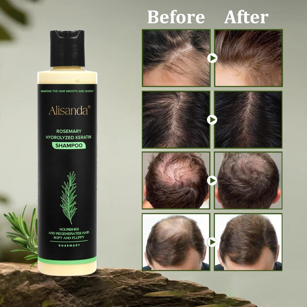 AuraRoot™ – Organisches Haarwachstum & Kopfhaut-Regeneration