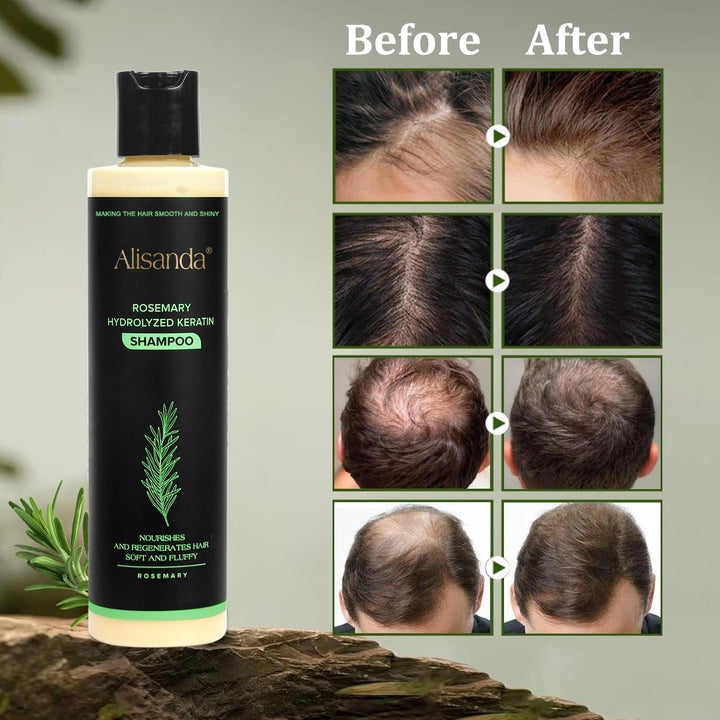 AuraRoot™ – Organisches Haarwachstum & Kopfhaut-Regeneration