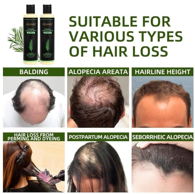 AuraRoot™ – Organisches Haarwachstum & Kopfhaut-Regeneration