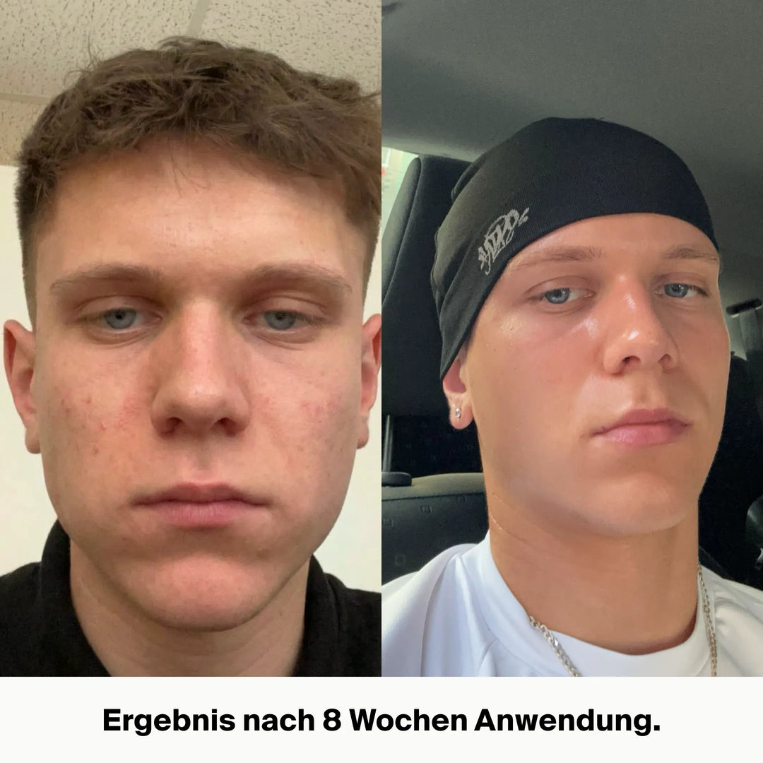 SkinLuxe™ Talg-Gesichtscreme für natürliche Feuchtigkeit