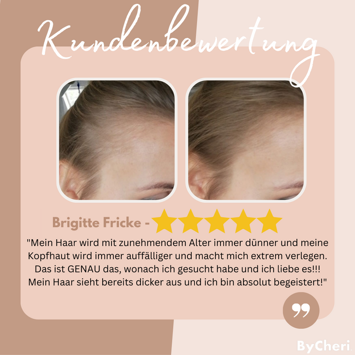 1+1 GRATIS NUR TEMPORÄR | EasyBlend™ - Bye-Bye Haaransatz