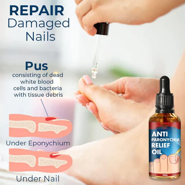 HealNail™ – Brittle Nail Repair für sichtbare Ergebnisse & einfache Anwendung [1 + 1 Gratis]