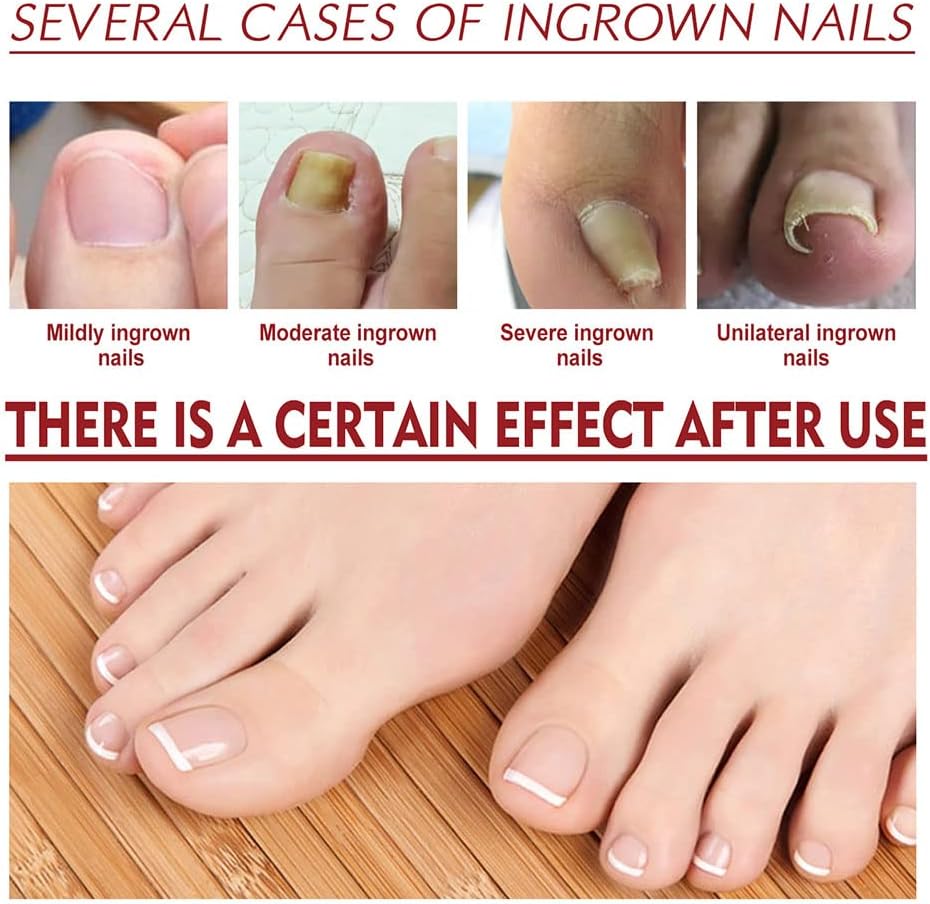 HealNail™ – Brittle Nail Repair für sichtbare Ergebnisse & einfache Anwendung [1 + 1 Gratis]