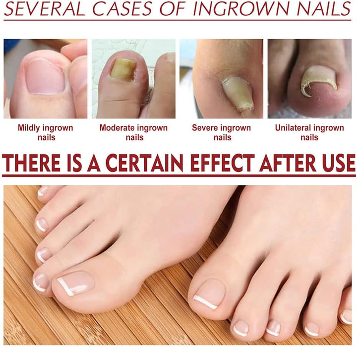 HealNail™ – Brittle Nail Repair für sichtbare Ergebnisse & einfache Anwendung [1 + 1 Gratis]