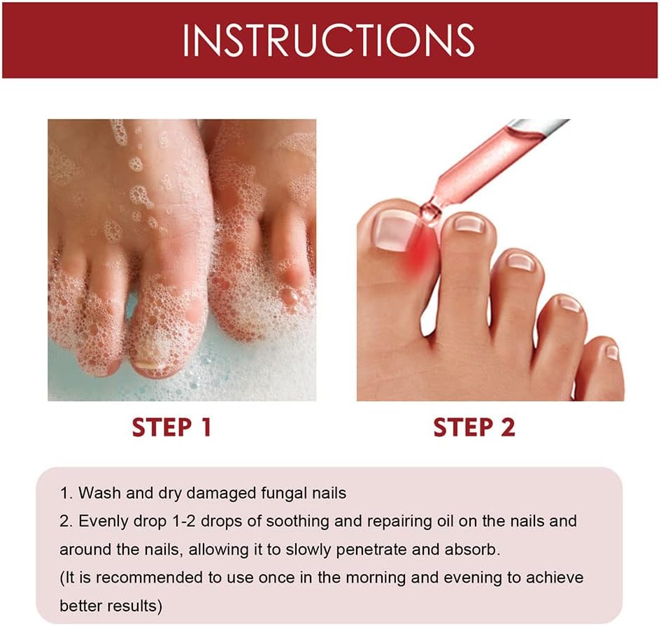 HealNail™ – Brittle Nail Repair für sichtbare Ergebnisse & einfache Anwendung [1 + 1 Gratis]