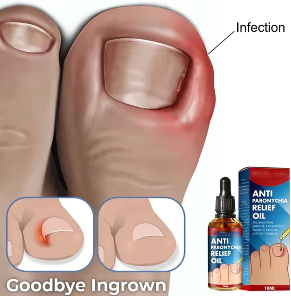 HealNail™ – Brittle Nail Repair für sichtbare Ergebnisse & einfache Anwendung [1 + 1 Gratis]