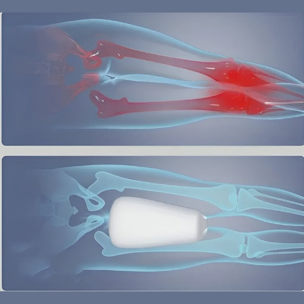 WolkenSchlaf™ Ergonomisches Bein- & Kniekissen