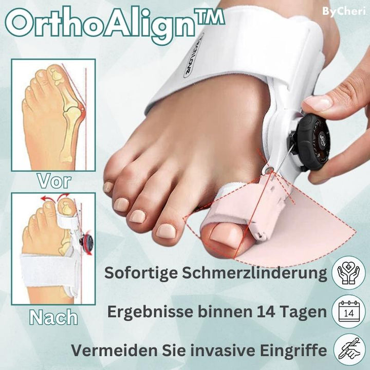 1+1 GRATIS TEMPORÄR | OrthoAlign™ – Großzehenkorrektor