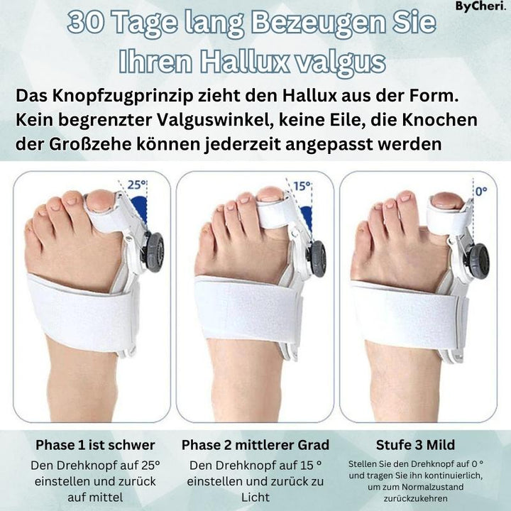 1+1 GRATIS TEMPORÄR | OrthoAlign™ – Großzehenkorrektor
