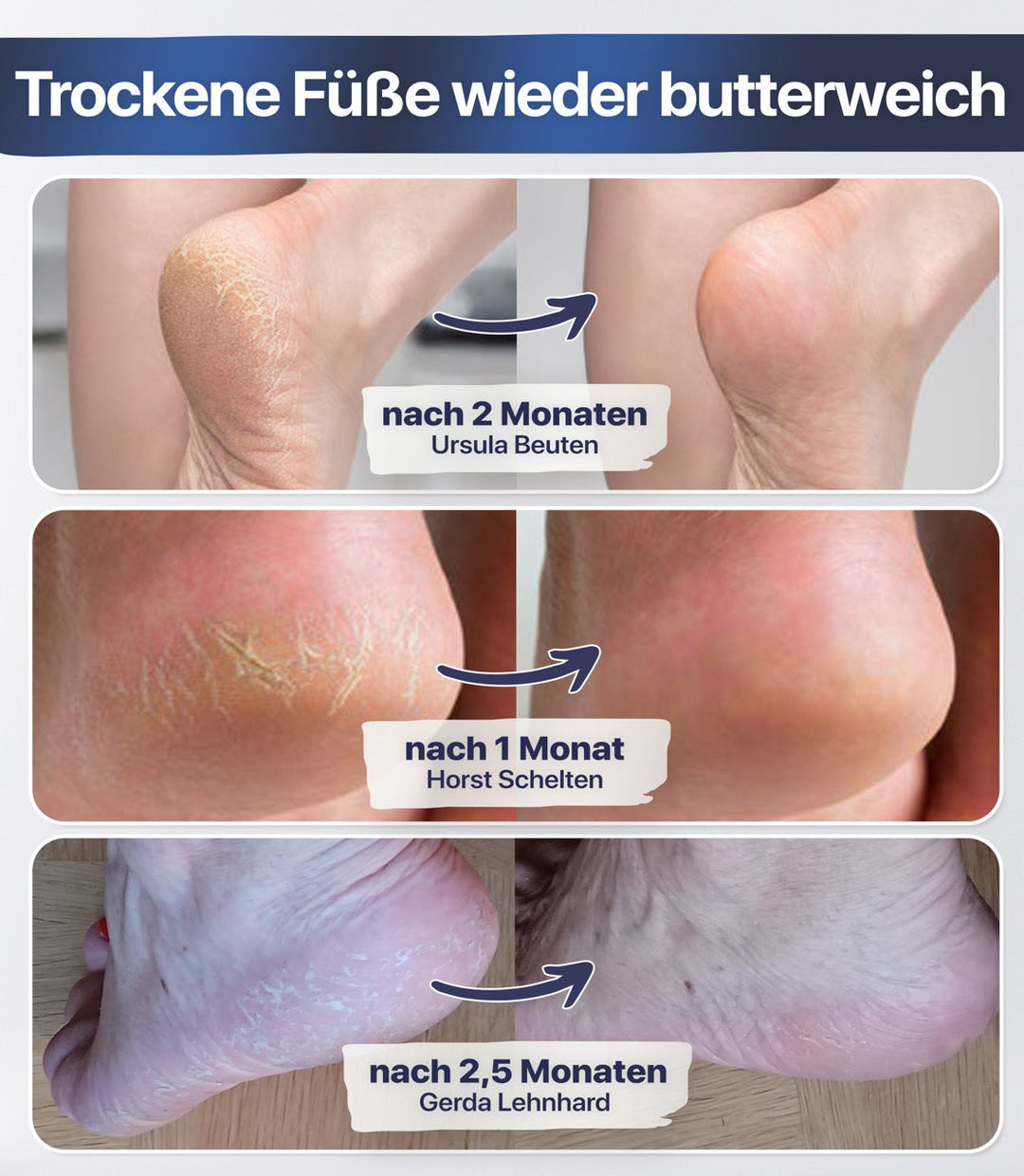 FußFrisch™ Erfrischendes Fußpflege-Spray