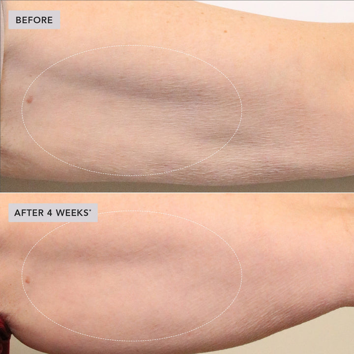 BODY GLP-1/GIP sculpt + firm treatment complex