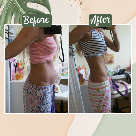 Perfect-Detox™ | Patch zur Gewichtsreduktion – Natürliche Unterstützung für Ihre Figur