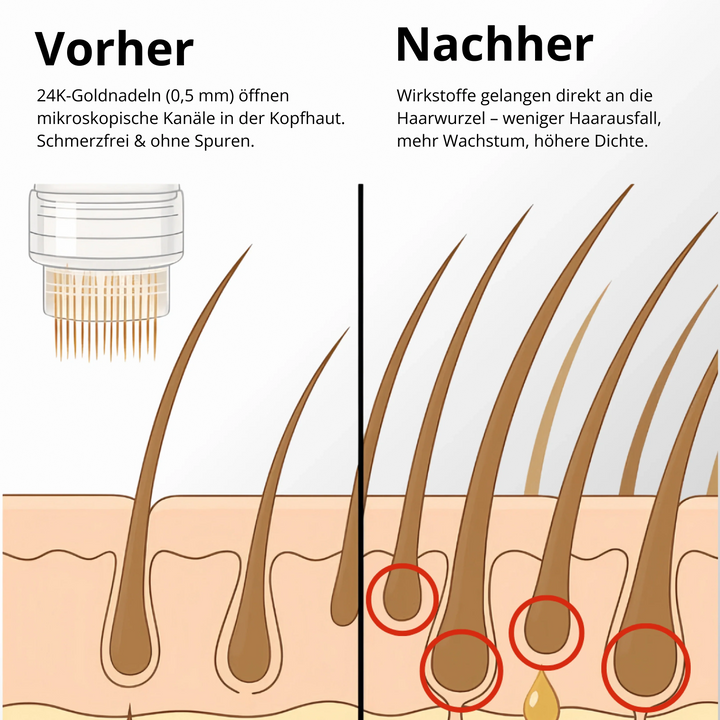 HairViva™ Haarwuchs-System für kräftigeres und dichteres Haar