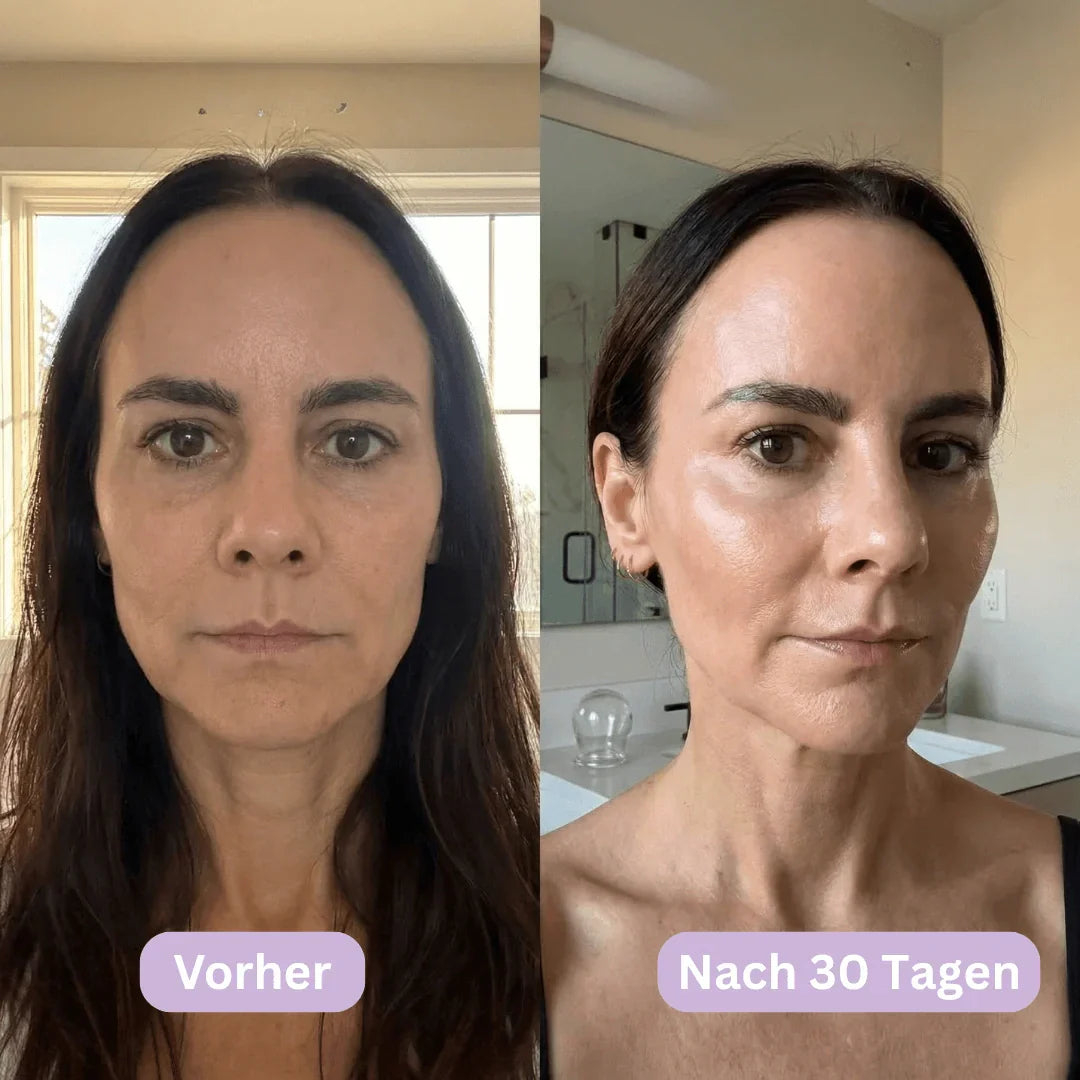 LymphCup™ | Endlich wieder aussehen wie du dich fühlst