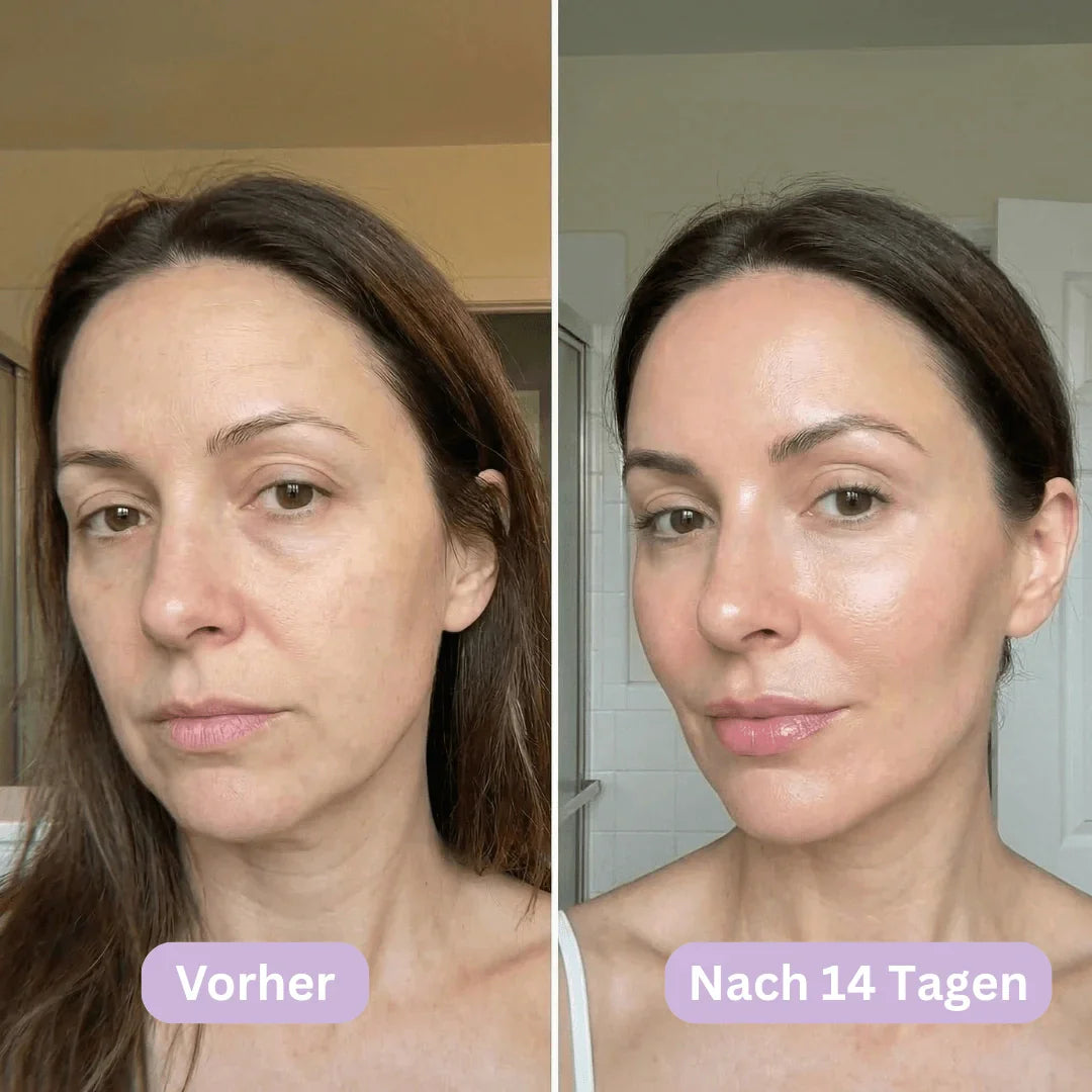 LymphCup™ | Endlich wieder aussehen wie du dich fühlst